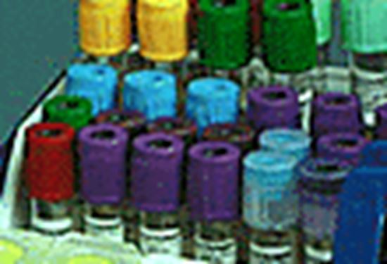 Picture of BD Blood Collection Set 23g ( 1 )